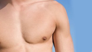 chest liposuction